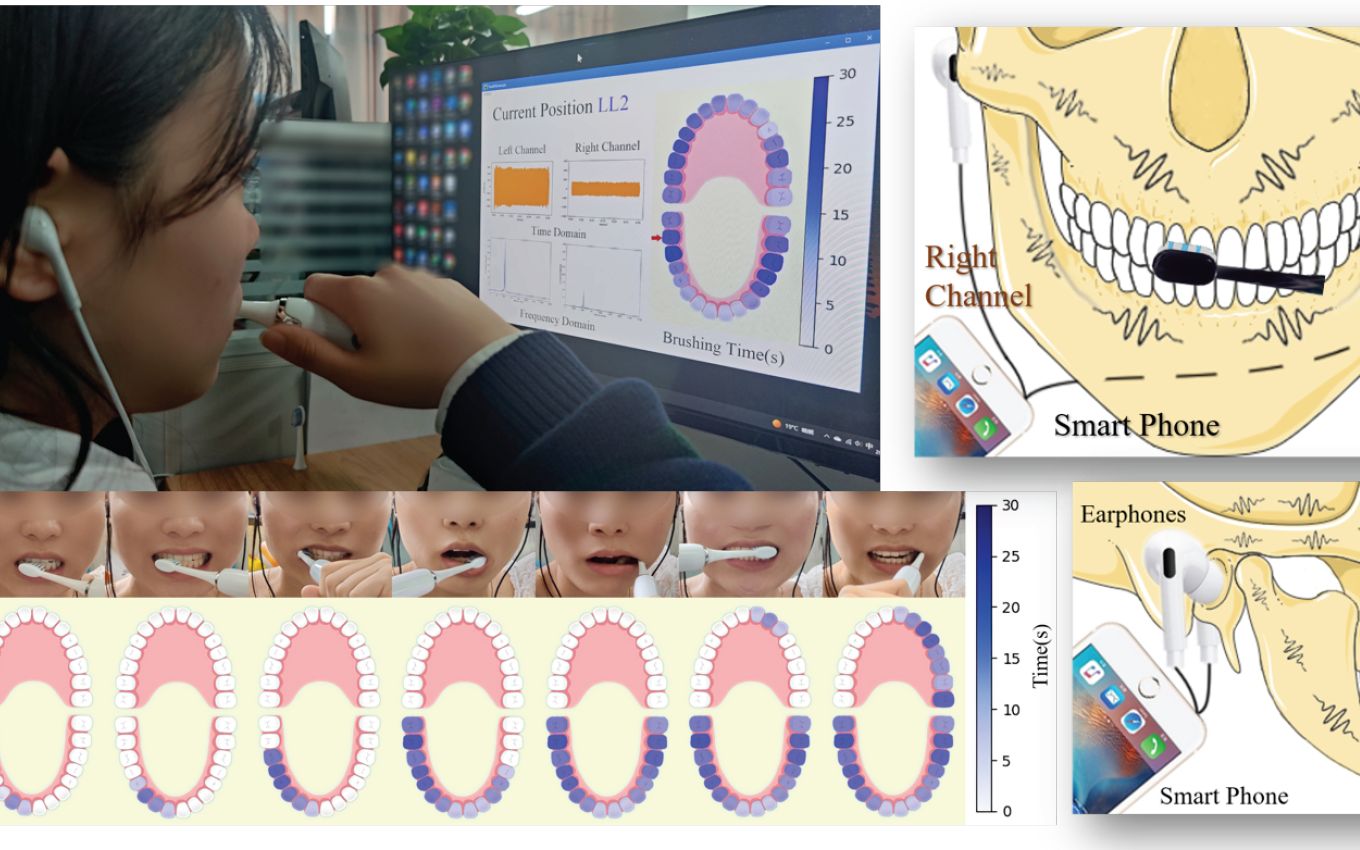 基于耳机逆向声传播的逐颗牙齿的刷牙计时辅助工具